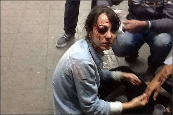 Repórter Giuliana Vallone da Folha de São Paulo é baleada no olho por PM que atirou bala de borracha contra ela. Ato ocorreu no protesto contra o aumento na tarifa de ônibus. Foto: : Diego Zanchetta/Estadão